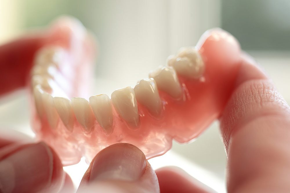 Quy trình trồng răng hàm giả tháo lắp gồm 4 bước